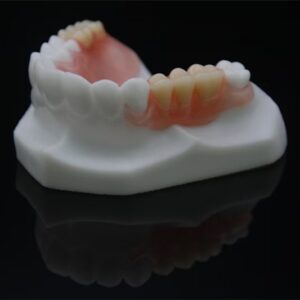Flexible partial denture on a dental model showing pink metal-free clasps for aesthetics