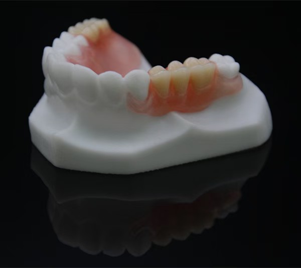 Flexible partial denture on a dental model showing pink metal-free clasps for aesthetics