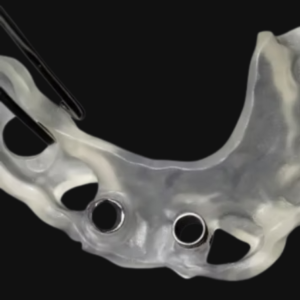 custom dental implant surgical guide for guided implant surgery