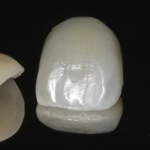 custom IPS e.max crown lithium disilicate ceramic dental restoration