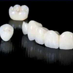 custom-dental-bridge-fixed-restoration