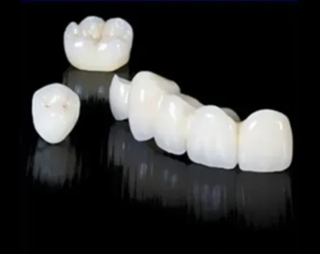 custom-dental-bridge-fixed-restoration