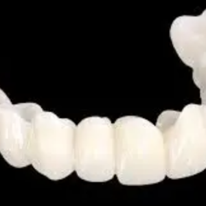 temporary dental bridge provisional crown and bridge restoration