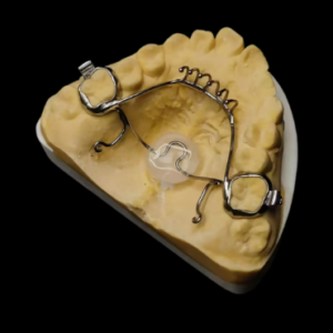 removable wire orthodontic appliance manufactured by HeZhan Dental Lab