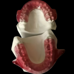 Custom Orthodontic Appliance HZ016