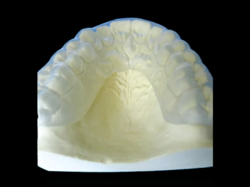 soft occlusal night guard for bruxism protection and teeth grinding