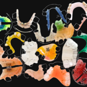 assorted custom orthodontic appliances with acrylic and wire designs