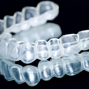 custom clear aligners transparent orthodontic appliance for teeth alignment