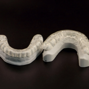 custom occlusal splint dental night guard for bruxism protection