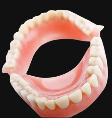 Custom complete denture manufactured for full arch tooth replacement and removable dental restoration.