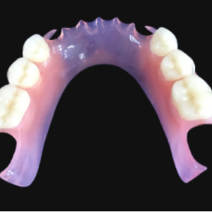 custom flexible partial denture removable dental prosthesis