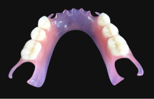 custom flexible partial denture removable dental prosthesis