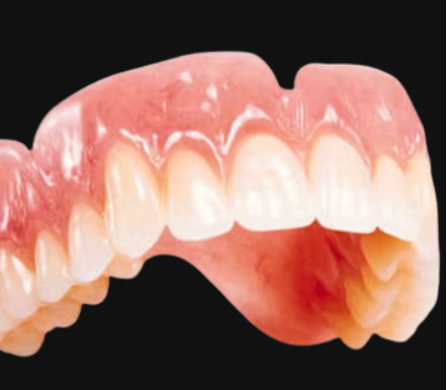 custom complete dentures removable dental prosthesis