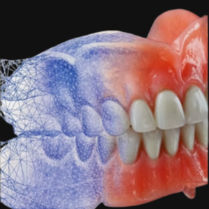 Digital Dentures