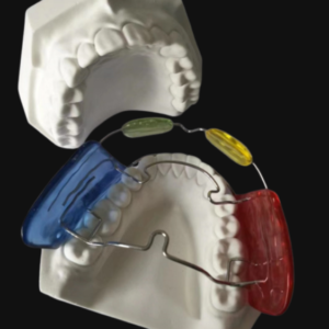 custom twin block functional orthodontic appliance with bite blocks for jaw development