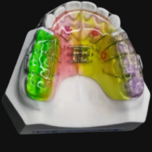 custom orthodontic expansion appliance dental laboratory