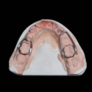 custom transpalatal arch appliance stainless steel orthodontic wire