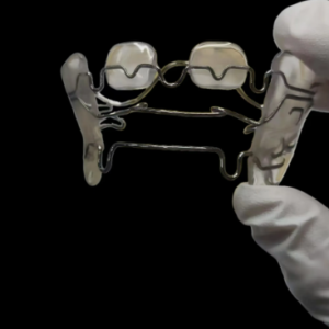 custom wire orthodontic appliance manufactured by HeZhan Dental Lab