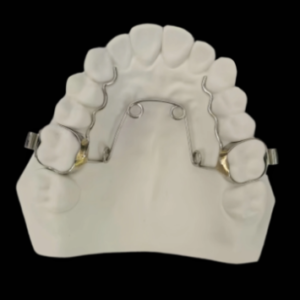 stainless steel quad helix orthodontic appliance for palatal expansion