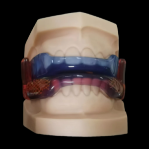 custom twin block functional orthodontic appliance for children