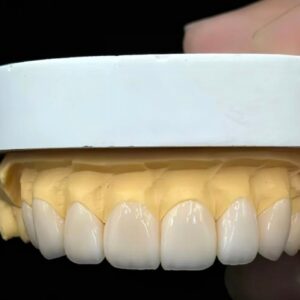 Temporary Dental Bridge for Provisional Crown and Bridge Restoration