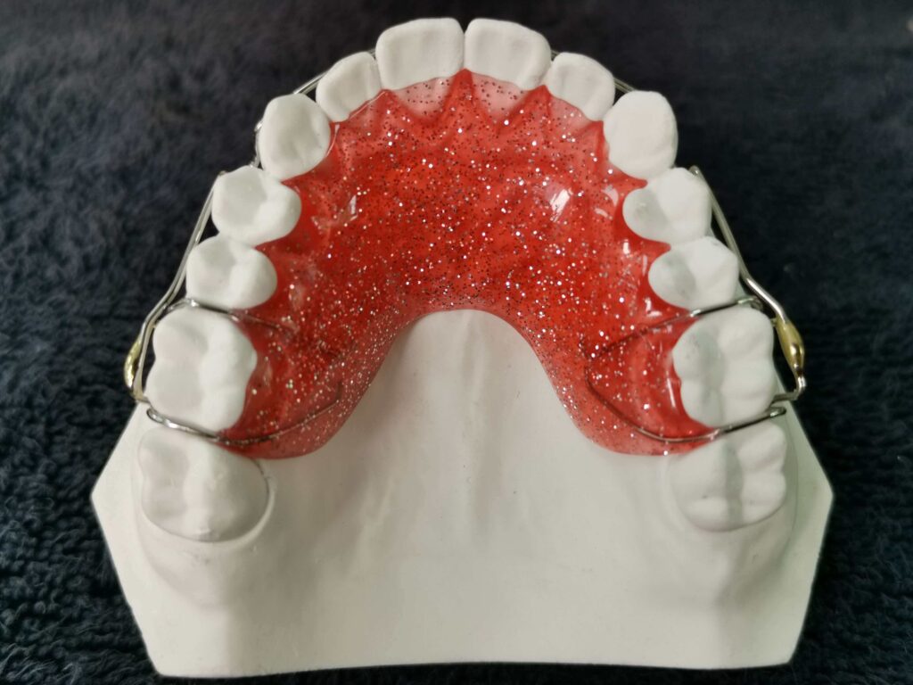 `Custom Modified Hawley Orthodontic Retainer with Soldered Clasp on Dental Model`
