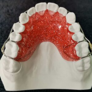 `Custom Modified Hawley Orthodontic Retainer with Soldered Clasp on Dental Model`