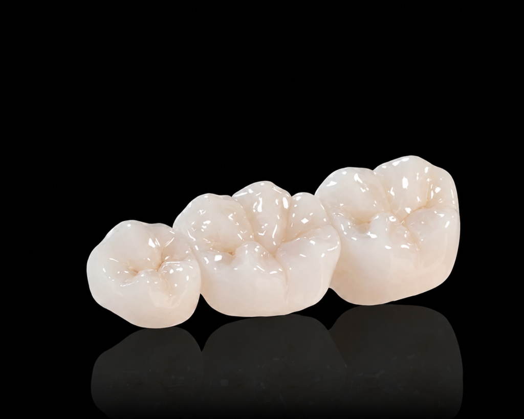 Monolithic zirconia dental bridge restoration for posterior teeth