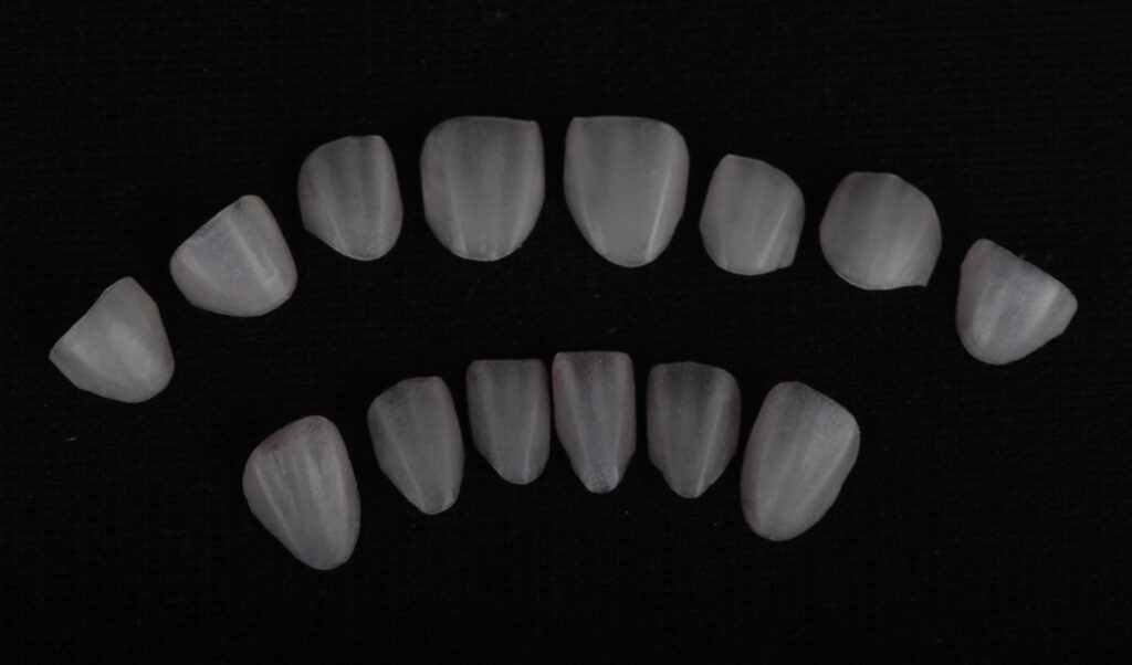 Lab Customized Porcelain Dental Veneers, Natural Shade Teeth Veneers International Supply