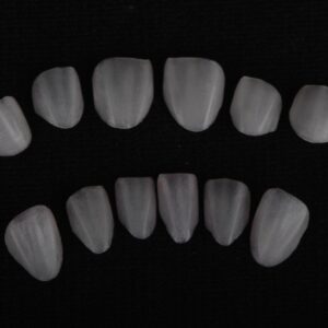 Lab Customized Porcelain Dental Veneers, Natural Shade Teeth Veneers International Supply