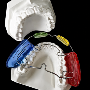 custom twin block functional orthodontic appliance with bite blocks for jaw development