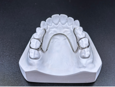 Stainless steel fixed W-arch maxillary expansion appliance mounted on a dental plaster model