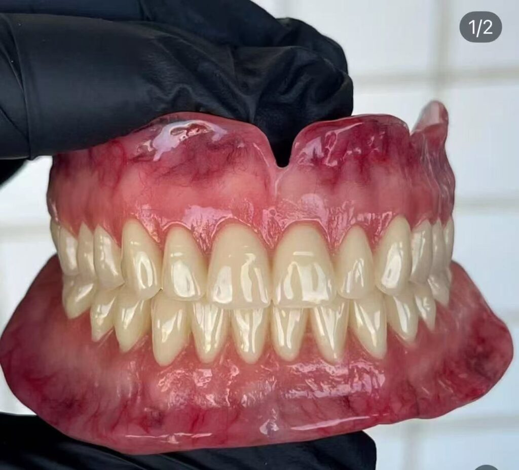 Custom complete denture manufactured for full arch tooth replacement and removable dental restoration.