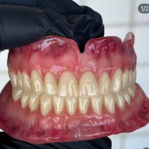 Custom complete denture manufactured for full arch tooth replacement and removable dental restoration.