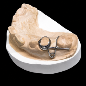 custom removable orthodontic appliance manufactured by HeZhan Dental Lab