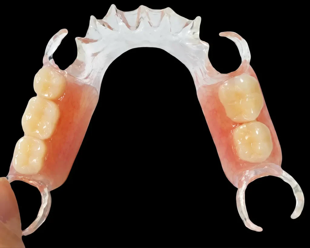 PEEK Partial Denture Framework Flexible Partial Dentures CAD/CAM Dental Prosthesis