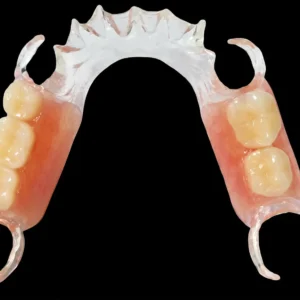 PEEK Partial Denture Framework Flexible Partial Dentures CAD/CAM Dental Prosthesis
