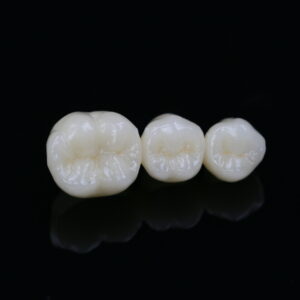 High-translucency full-contour multilayer zirconia dental bridge showing precise occlusal anatomy