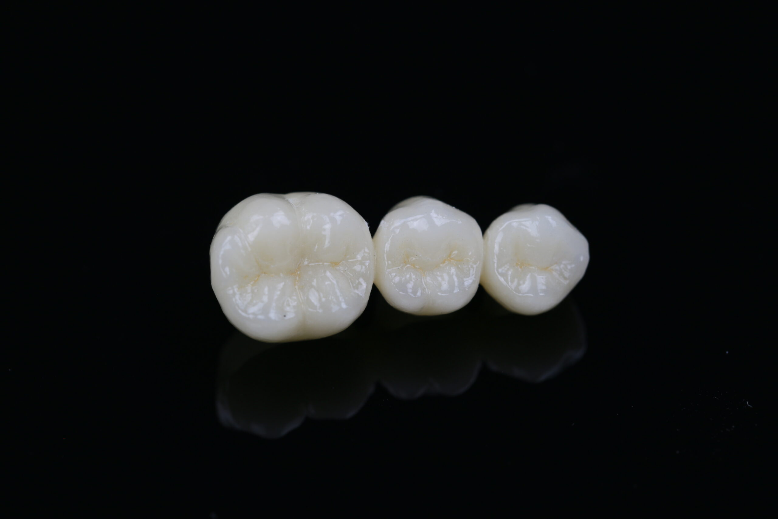 High-translucency full-contour multilayer zirconia dental bridge showing precise occlusal anatomy