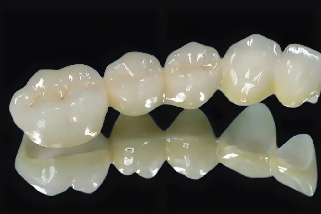 Crown and bridge dental restorations including zirconia and ceramic crowns