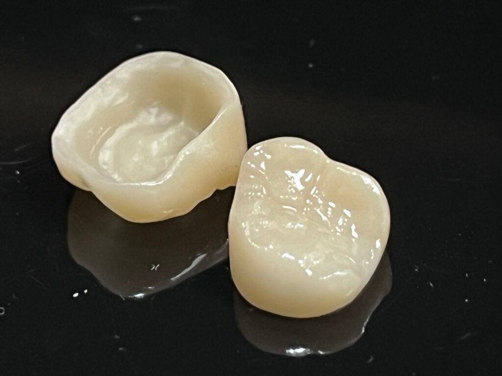 Custom full ceramic dental crown restoration for dental clinics and laboratories